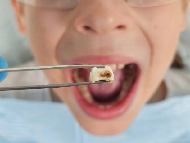 Best Emergency Root Canal Treatment in Woodsboro, MD