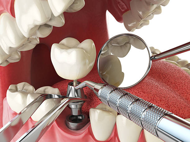 , MD Emergency Dentist Company